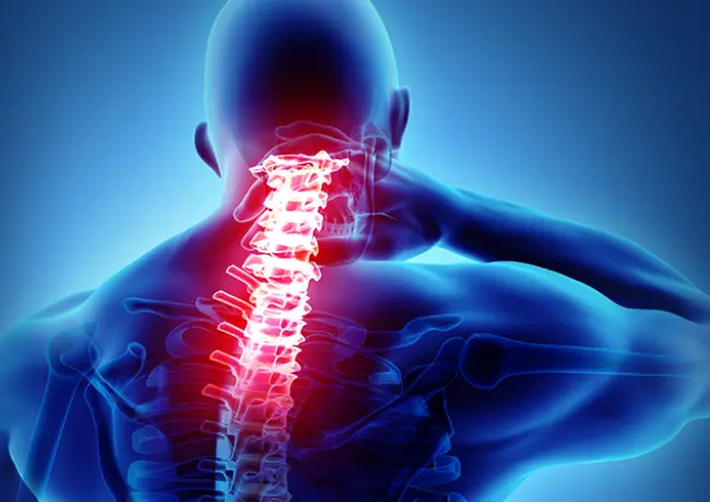 Cervical Myelopathy Treatment In Mumbai Get Expert Care