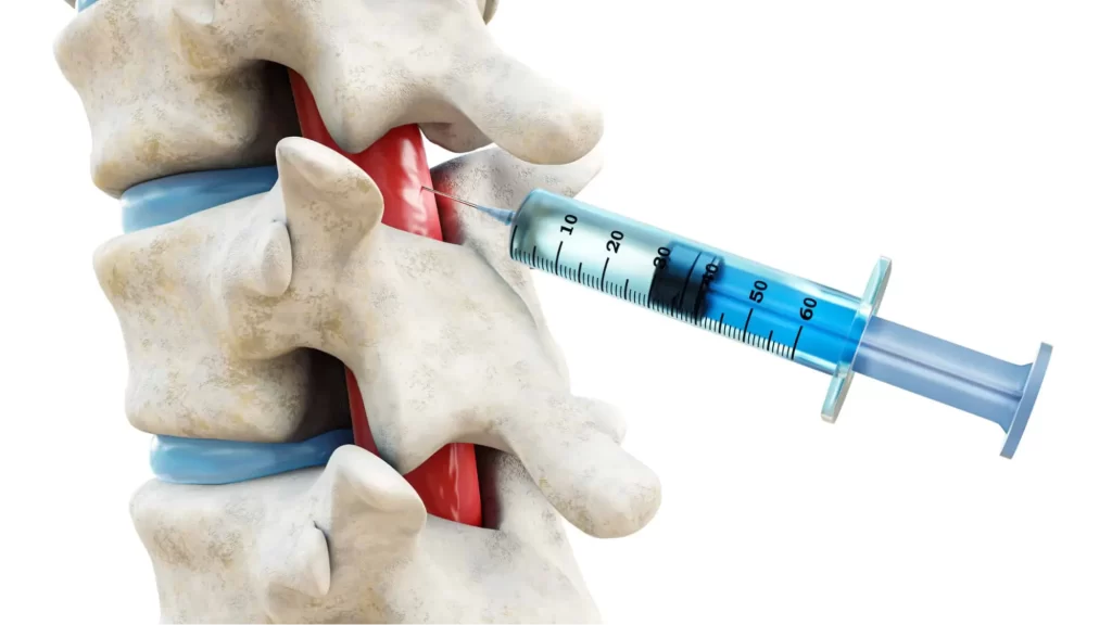 Spinal Injections In Mumbai