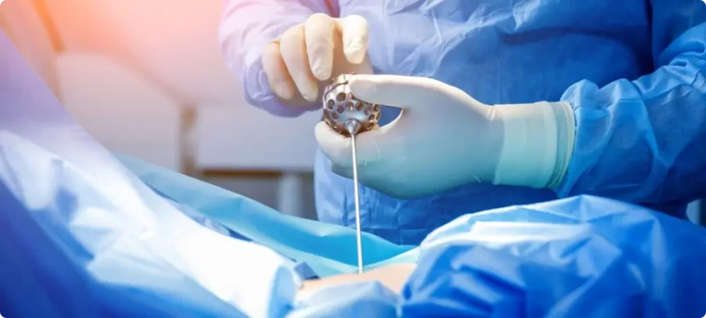 laminectomy surgery in Mumbai for slip disc treatment