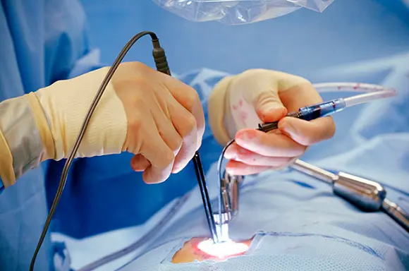 procedure for laser spine surgery in Mumbai