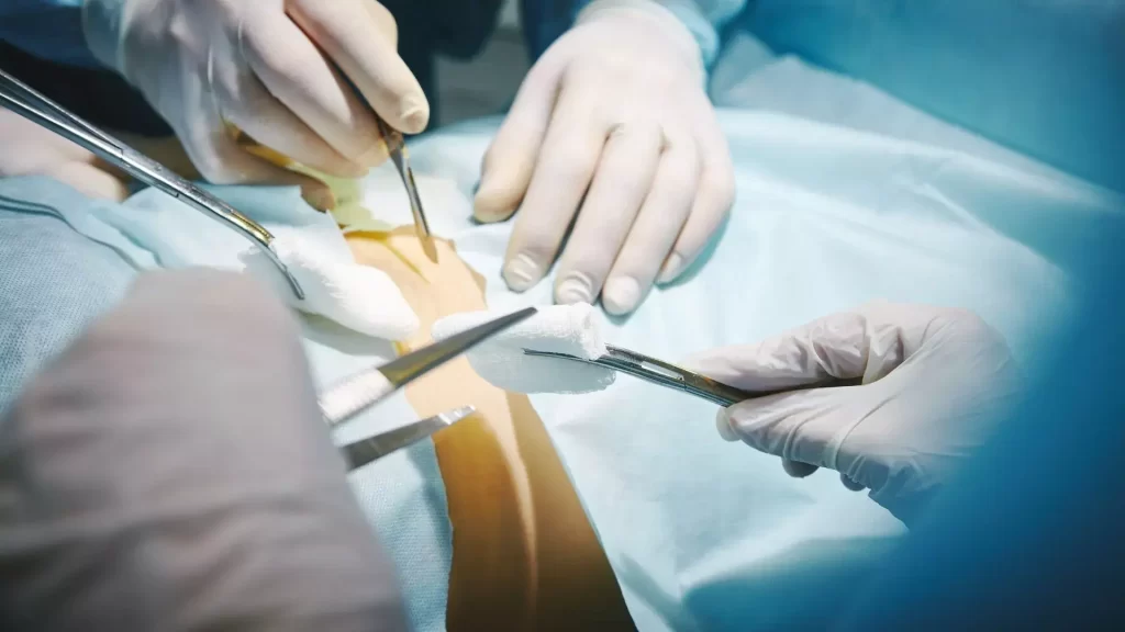 procedure laminectomy surgery in Mumbai