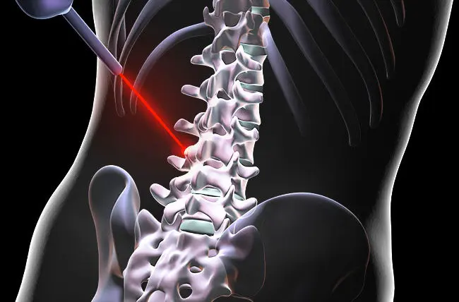 surgery for back pain treatment in Mumbai