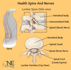 What is Spinal stenosis - Symptoms and causes & Treatment_