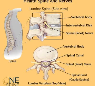 What is Spinal stenosis - Symptoms and causes & Treatment_