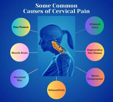 How to Manage Cervical Pain